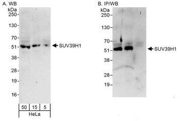 Rabbit SUV39H1 Antibody