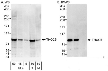 Rabbit THOC5 Antibody