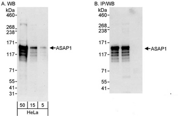 Rabbit ASAP1 Antibody