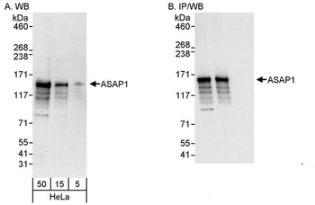 Rabbit ASAP1 Antibody