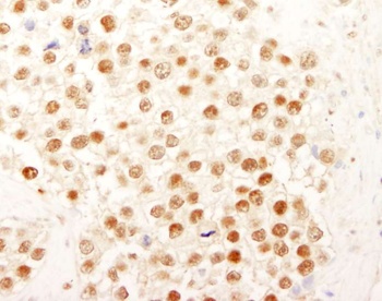 Rabbit NF-YC Antibody