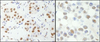 Rabbit NF-YA Antibody