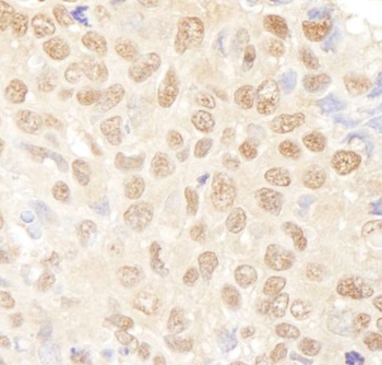 Rabbit NF-YA Antibody