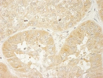 Rabbit LARP1 Antibody