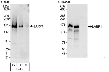 Rabbit LARP1 Antibody