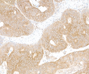 Rabbit LARP1 Antibody