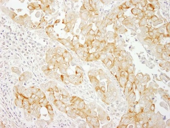 Rabbit Notch2 Antibody