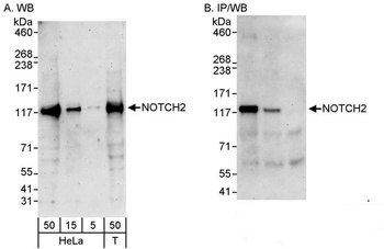 Rabbit Notch2 Antibody