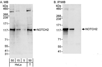 Rabbit Notch2 Antibody
