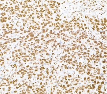 Rabbit RALY Antibody