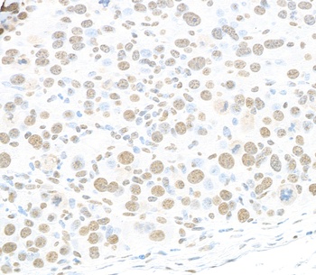 Rabbit RALY Antibody