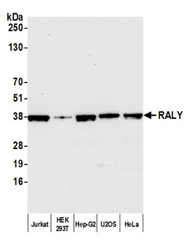 Rabbit RALY Antibody