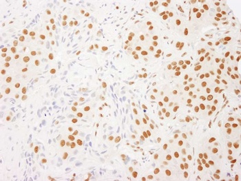 Rabbit RALY Antibody
