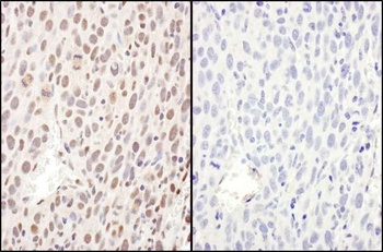 Rabbit Phospho RelA (S468) Antibody