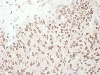 Rabbit Phospho RelA (S468) Antibody