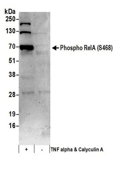 Rabbit Phospho RelA (S468) Antibody