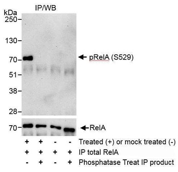 Rabbit Phospho RelA (S529) Antibody