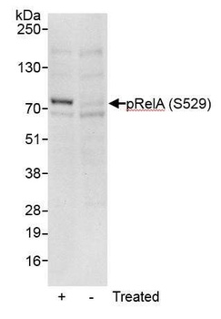 Rabbit Phospho RelA (S529) Antibody