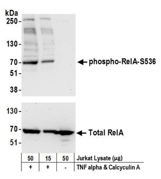 Rabbit Phospho RelA (S536) Antibody