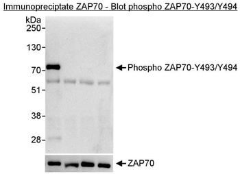 Rabbit Phospho ZAP70 (Y493/Y494) Antibody