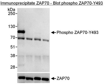 Rabbit Phospho ZAP70 (Y493) Antibody