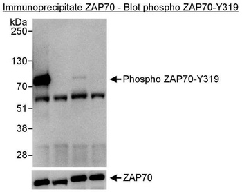 Rabbit Phospho ZAP70 (Y319) Antibody