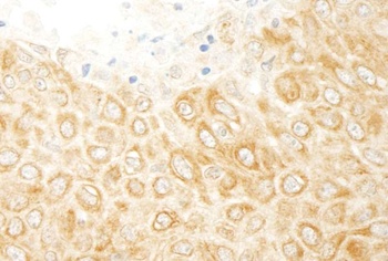 Rabbit anti-ZAK Antibody