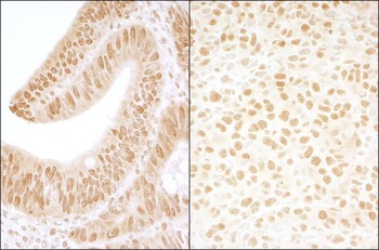 Rabbit CKII beta Antibody