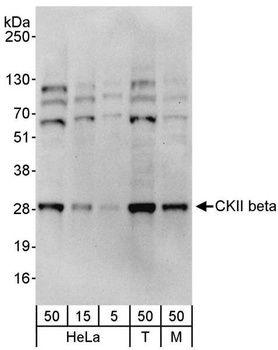 Rabbit CKII beta Antibody