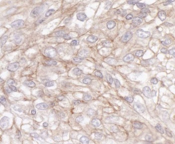 Rabbit IQGAP1 Antibody