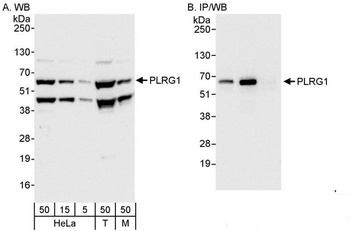Rabbit PLRG1 Antibody