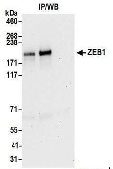 Rabbit ZEB1 Antibody