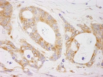 Rabbit EML4 Antibody