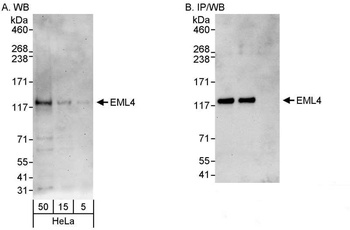 Rabbit EML4 Antibody