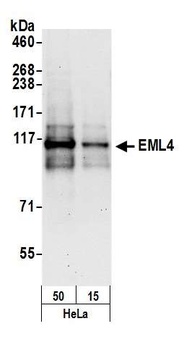 Rabbit EML4 Antibody