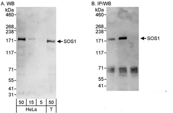 Rabbit SOS1 Antibody