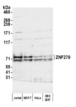 Rabbit ZNF276 Antibody