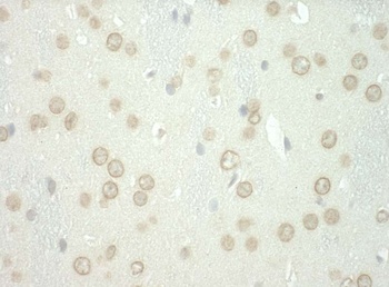 Rabbit WDFY3 Antibody