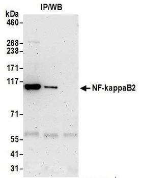 Rabbit NF-kappaB2 Antibody