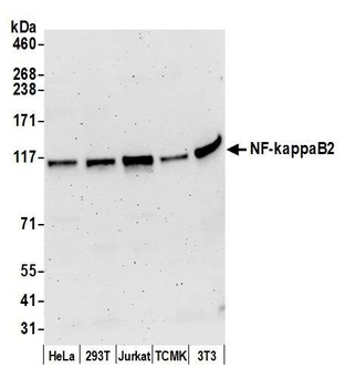 Rabbit NF-kappaB2 Antibody