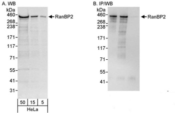 Rabbit RanBP2 Antibody