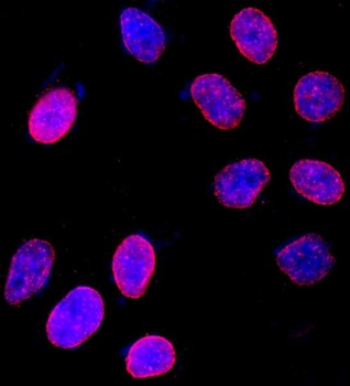 Rabbit NUP153 Antibody