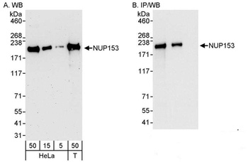 Rabbit NUP153 Antibody