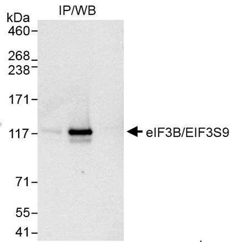 Rabbit anti-eIF3B/EIF3S9 Antibody