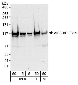 Rabbit anti-eIF3B/EIF3S9 Antibody