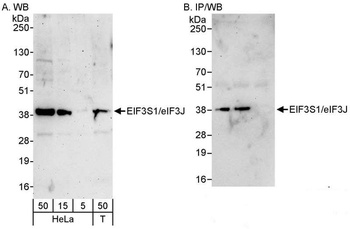 Rabbit eIF3J/EIF3S1 Antibody