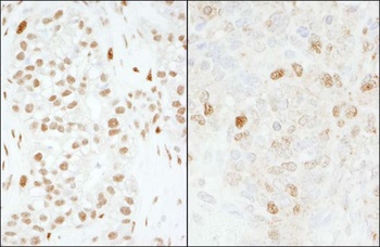 Rabbit FOXK1 Antibody