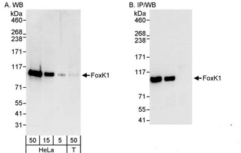 Rabbit FOXK1 Antibody