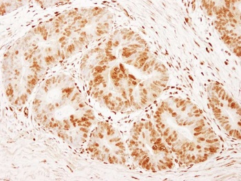 Rabbit FOXK1 Antibody
