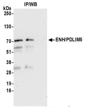Rabbit ENH/PDLIM5 Antibody